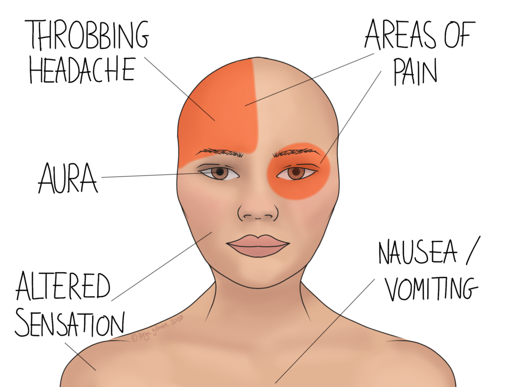 Symptoms of migraines