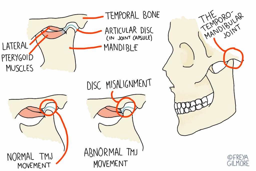 The TMJ (temporomandibular joint)